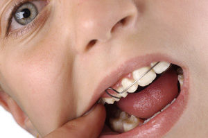 Ortopedia-Dentofacial-2