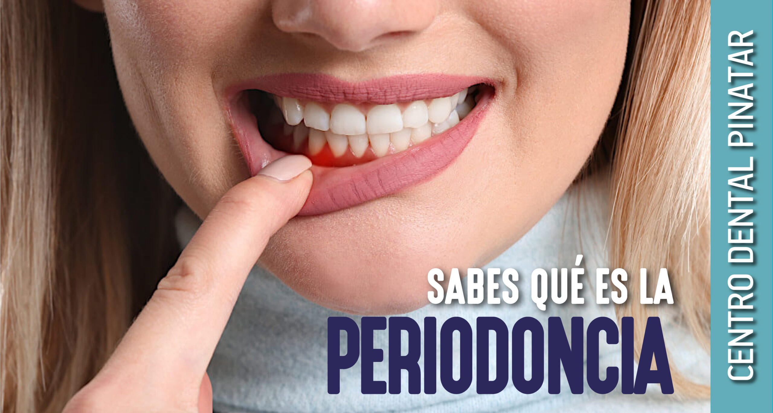 CENTRO-DENTAL-PINATAR-07